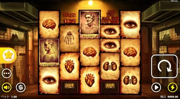 メンタル(Mental)のゲーム画面全体